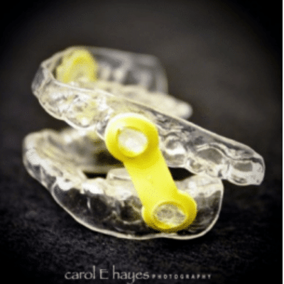 Emerson ema appliance, replacement for cpap machine