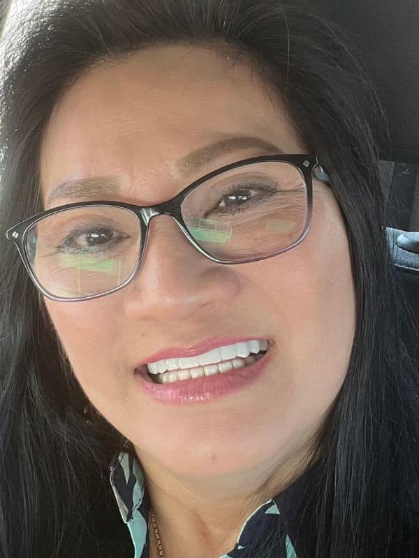 Female smile transformation by doctor anthony martin after treatment veneer