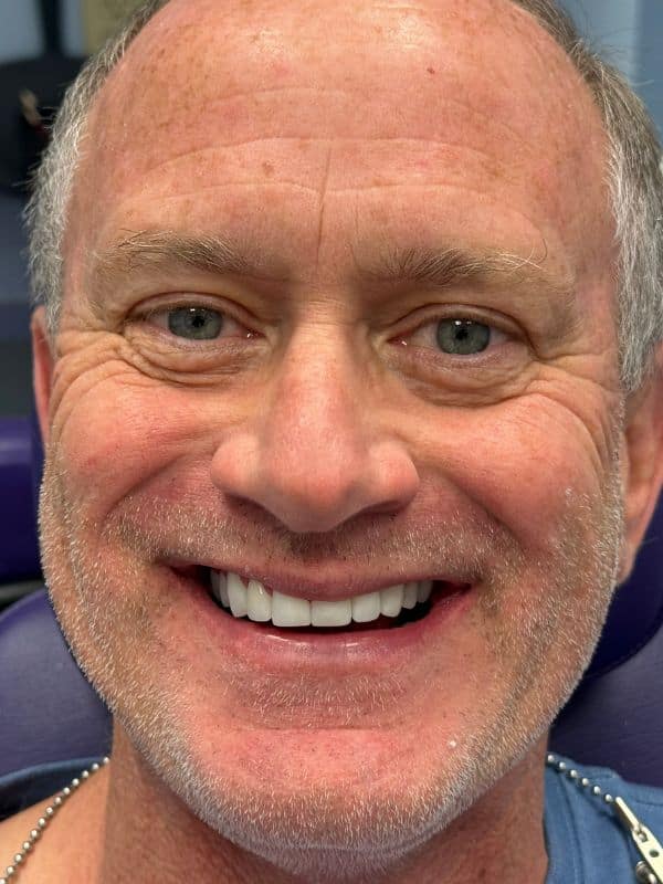 Male smile transformation by doctor anthony martin after treatment