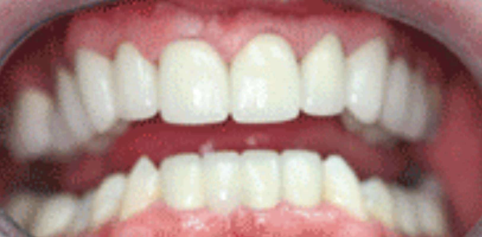 Before & after 21 Cosmetic dentistry at anthony martin