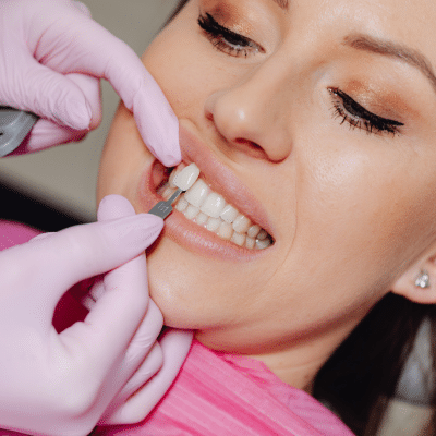 A woman getting dental veneers, representing what to expect with veneers